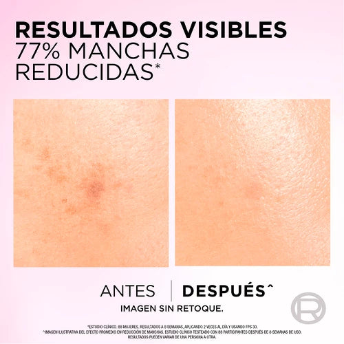 ✨ Anti-manchas y renovación - Sérum L'Oréal