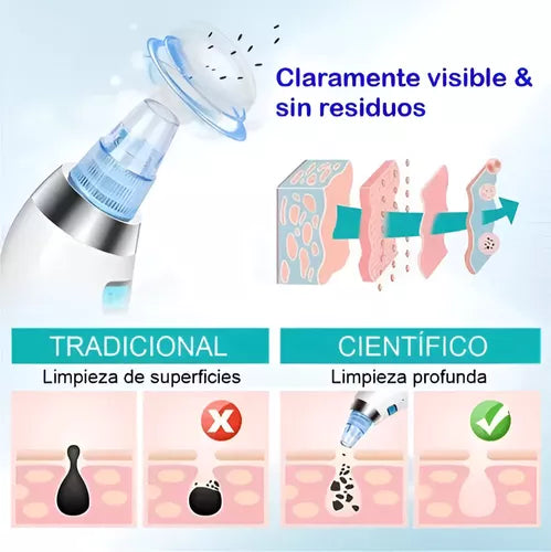 🔆 Limpieza facial profunda en casa - Eliminador de puntos negros