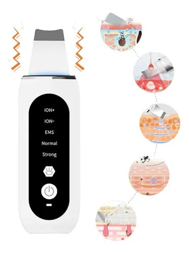 🌟 Depurador Espátula Ultrasónica 5 en 1 para el Cuidado Facial 🌟