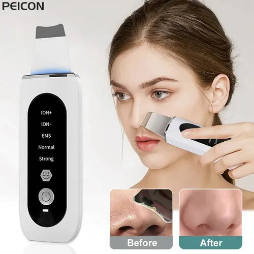🌟 Depurador Espátula Ultrasónica 5 en 1 para el Cuidado Facial 🌟